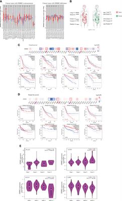 ERBB2 promoter demethylation and immune cell infiltration promote a poor prognosis for cancer patients